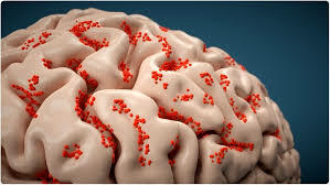 Brain Virus
