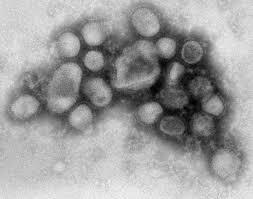 H1N1
