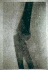 Primer radiografía de México.