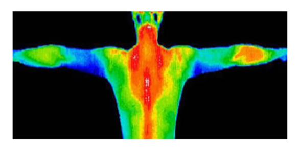 Ley de la radiosensibilidad de los tejidos.