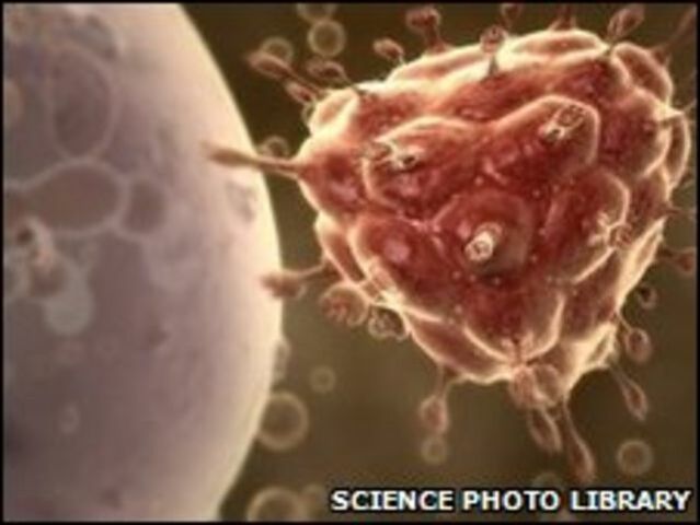 Virus de Inmunodeficiencia Adquirida (VIH)