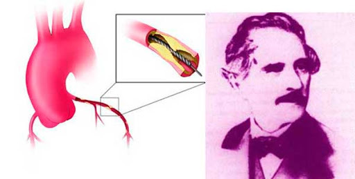 CONSTRUCCIÓN DE PROTESIS