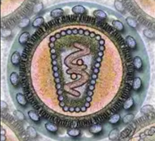 Virus de Inmunodeficiencia adquirido (VIH)