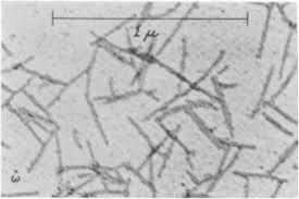 Cristales del virus del mosaico del tabaco