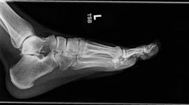 Timeline: Descubrimiento de los rayos X (100 años antes)