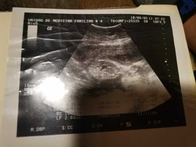 NACIMIENTO DE MI HERMANO