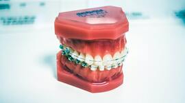 Timeline: La Historia De La Odontología