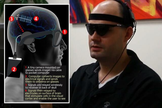Orion Cortical Visual Prosthesis System