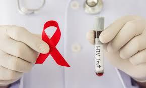 Virus de Inmunodeficiencia Adquirida (VIH)