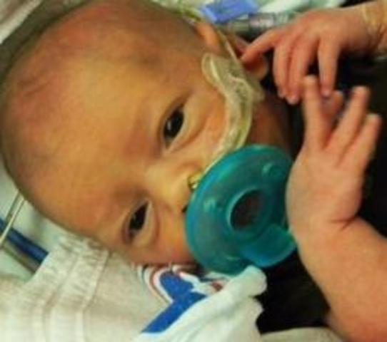 Dylan Russell Dove was born and had surgery. He was sent off to the USA NICU for 20 days.