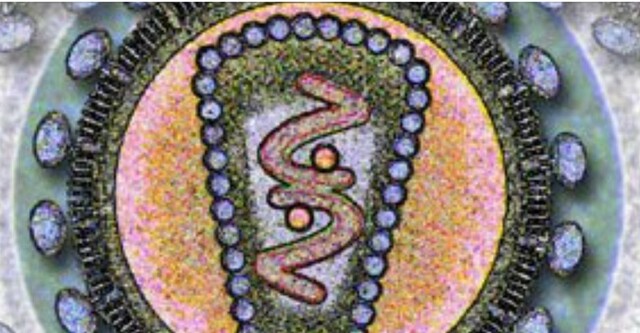 Virus de Inmunodeficiencia Adquirida (VIH)