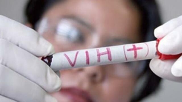 Virus de Inmunodeficiencia Adquirida (VIH)