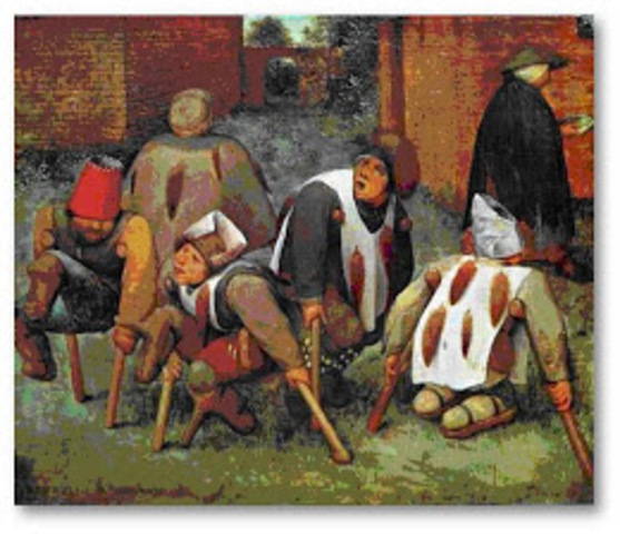 Pessoas com Necessidades Especiais eram Queimadas