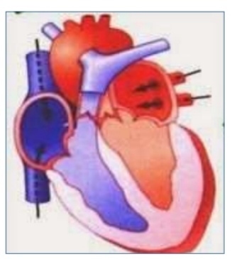 Diástole ventricular