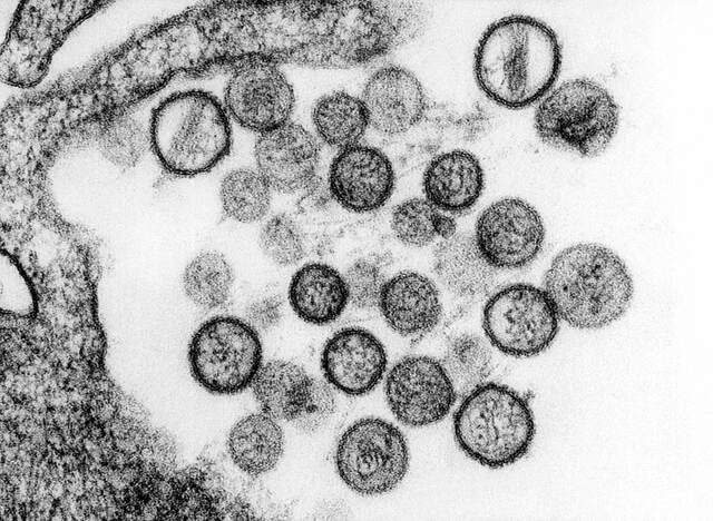 VIRUS DE INMUNODEFICIENCIA ADQUIRIDO (VIH)