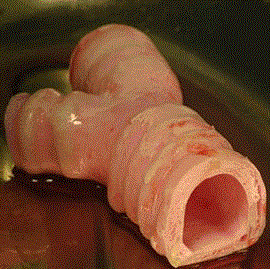 Siglo XXI Primer trasplante de un órgano completo cultivado