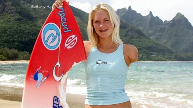Bethany Hamilton Loses her Arm
