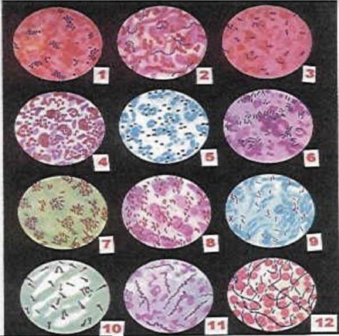 Transformación genética