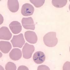 Babesia Microti