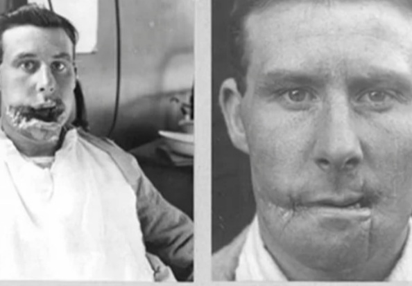 Cirurgias plásticas