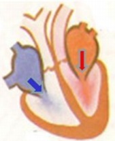Contracción auricular