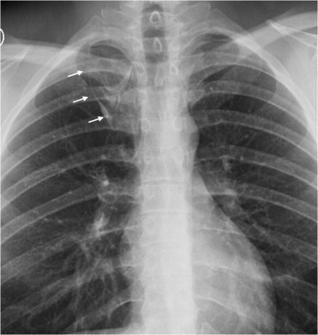 Radiografías  C. Comas