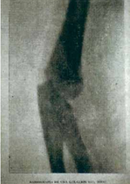 El relato de la primera radiografía en México