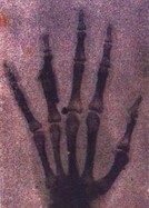 Radiografia en la Republica Mexicana