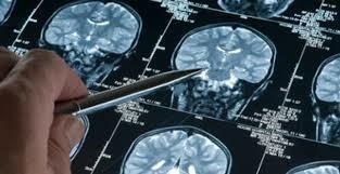 México. Los primeros estudios conocidos