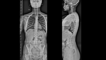 Una nueva primera radiografía