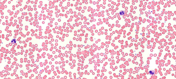 Anton van Leeuwenhoek viewed blood cells under a microscope