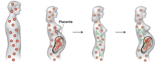 Karl Landsteiner discovered the Rh protein