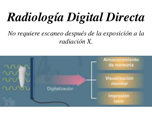 Radiología digital directa