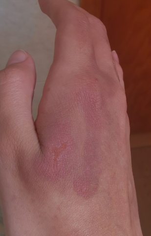 ¿Acaso podría empeorar?