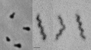 Mollicutes (Phytoplasma)