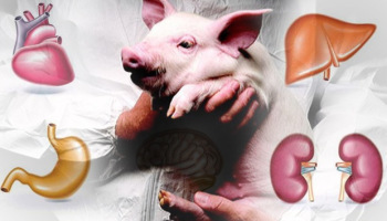 Primer Xenotransplante