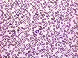 Anton van Leeuwenhoek