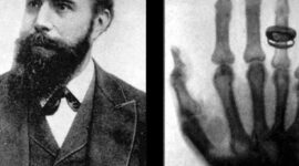 Timeline: Historia de la radiología