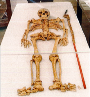 It really was his skeleton!