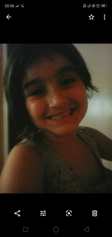 CAIGUDA DE LA PRIMERA DENT