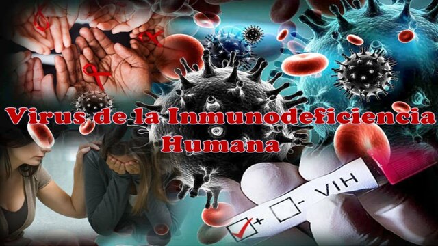 Virus de Inmunodeficiencia Adquirida (VIH)