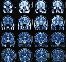 CONTINUAN LOS AVANCES