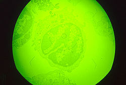 La peste porcina africana