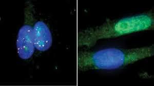 CRISPR 2.0, capaz de editar una sola base de ADN, podría curar decenas de miles de mutaciones