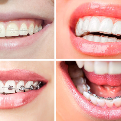 Timeline: Ortodoncia