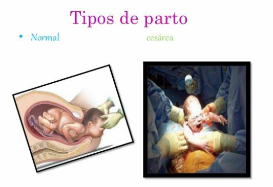 TIPOS DE PARTO