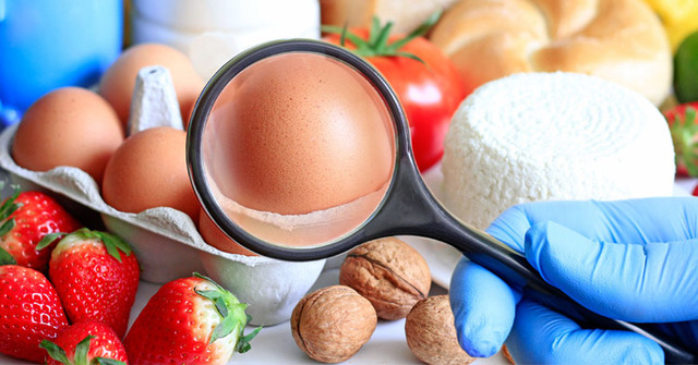 Seguridad alimentaria