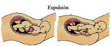 NACIMIENTO O EXPULSIÓN