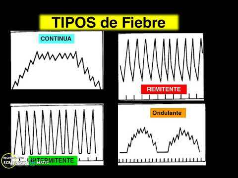 tipos de fiebre