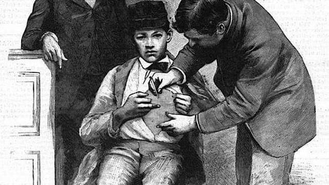 Vacuna contra la rabia por L. Pasteur.